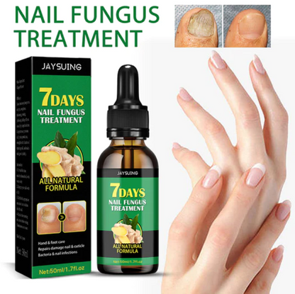 Compra 1 y llevate 2👋🦠Anti Hongos Uñas - 7 Days™  2UND 30ml